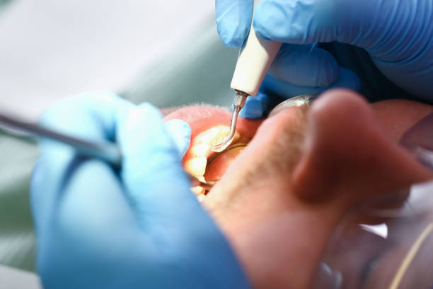 Best Emergency Dentist for Knocked-Out Tooth in Jamestown, ND