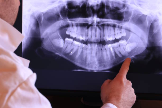Best Emergency Dentist for Special Needs Patients in Jamestown, ND